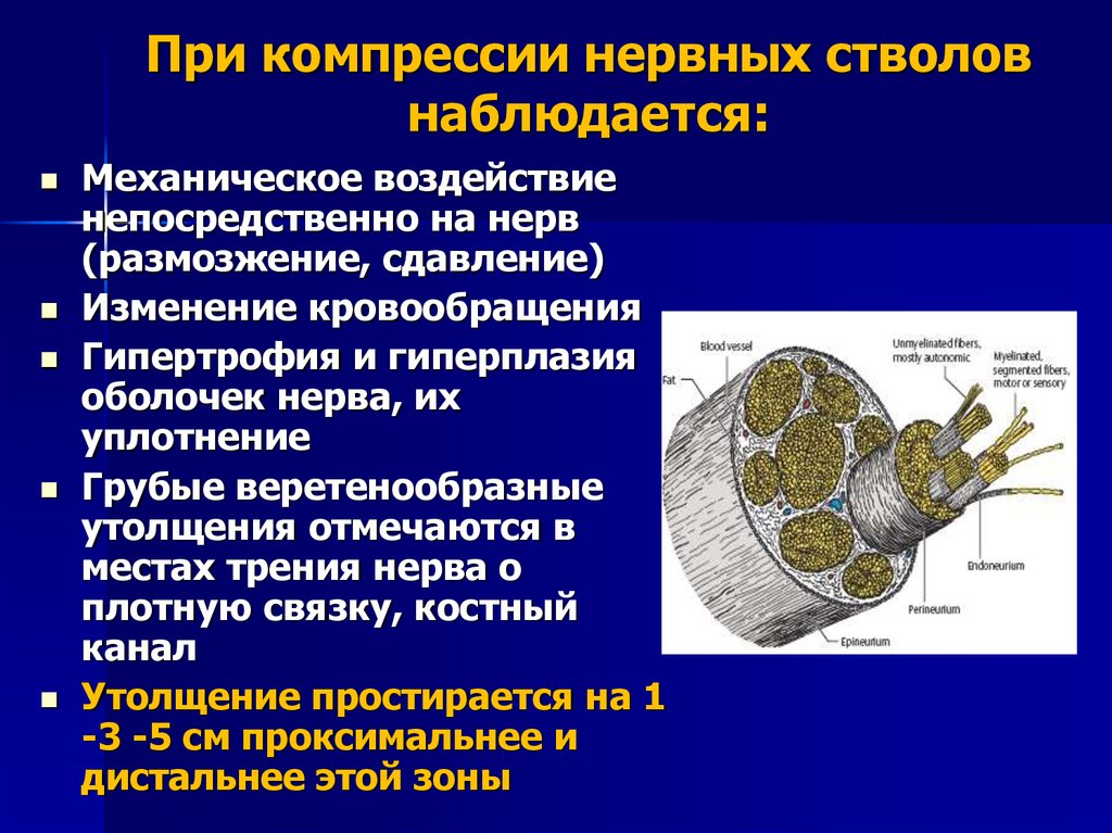 Типы нервных стволов