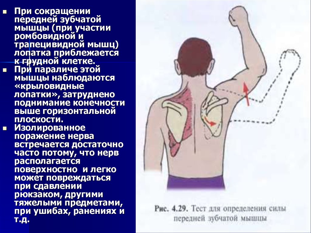 Парез дюшена эрба это. Симптом крыловидной лопатки. Укорочение передней зубчатой мышцы. Парез передней зубчатой мышцы. Паралич передней зубчатой мышцы.