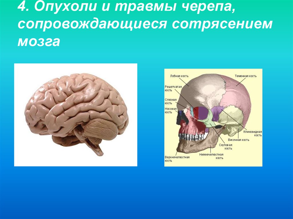 Травмы черепа и головного мозга. Слайд множественные травмы черепа. Физическая травма черепа.