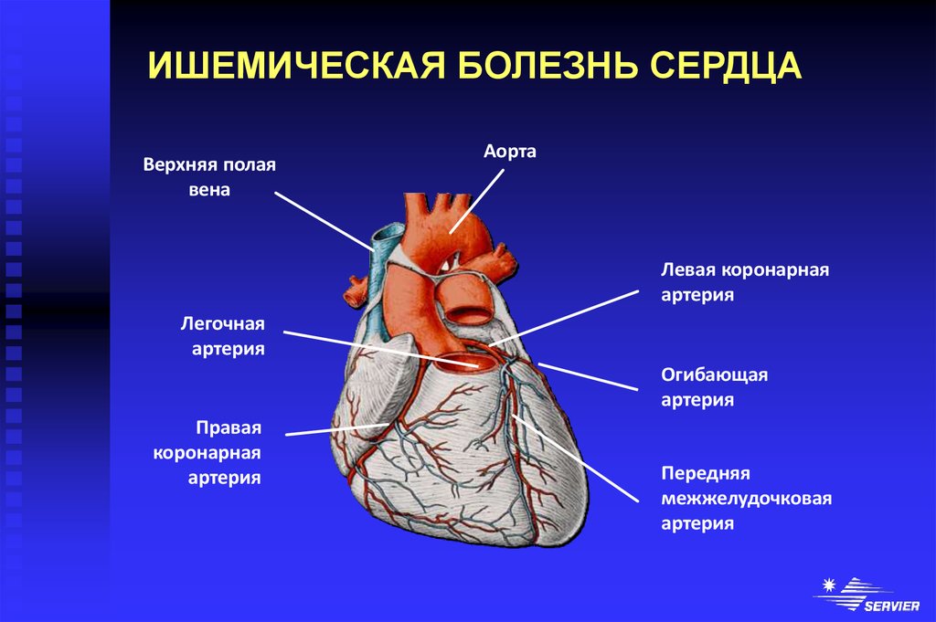 Области ишемии. Коронарные венечные сосуды. Ишемическая болезнь сердца. Коронарные заболевания сердца. Сердца анатомия ишемия.