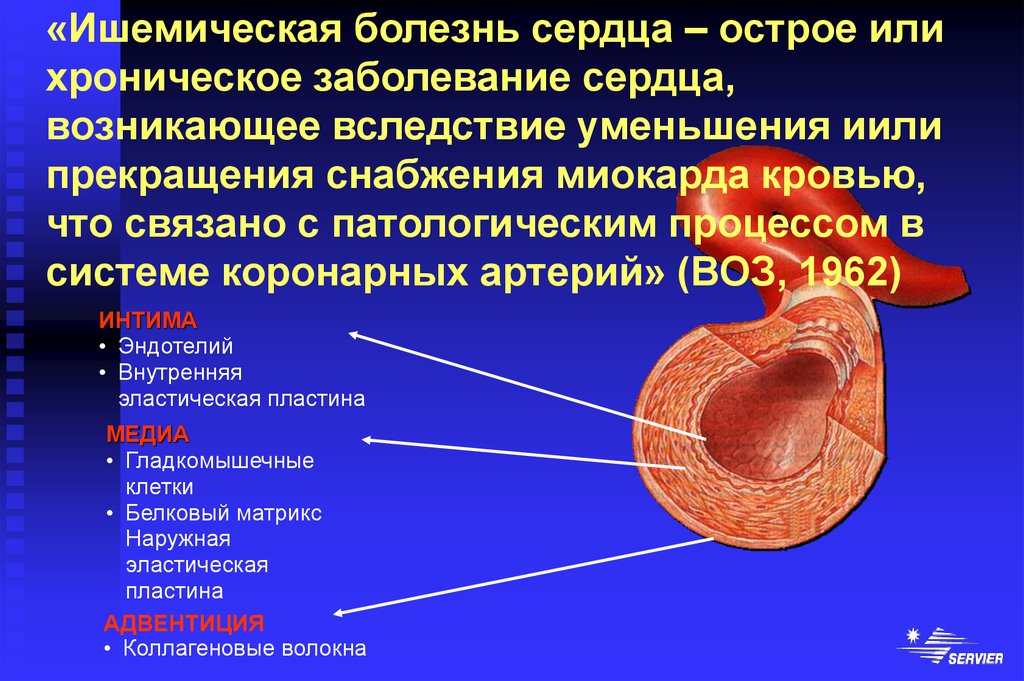 Факторы ишемии. Хроническая ишемия миокарда. Ишемическая болезнь сердца (ИБС).