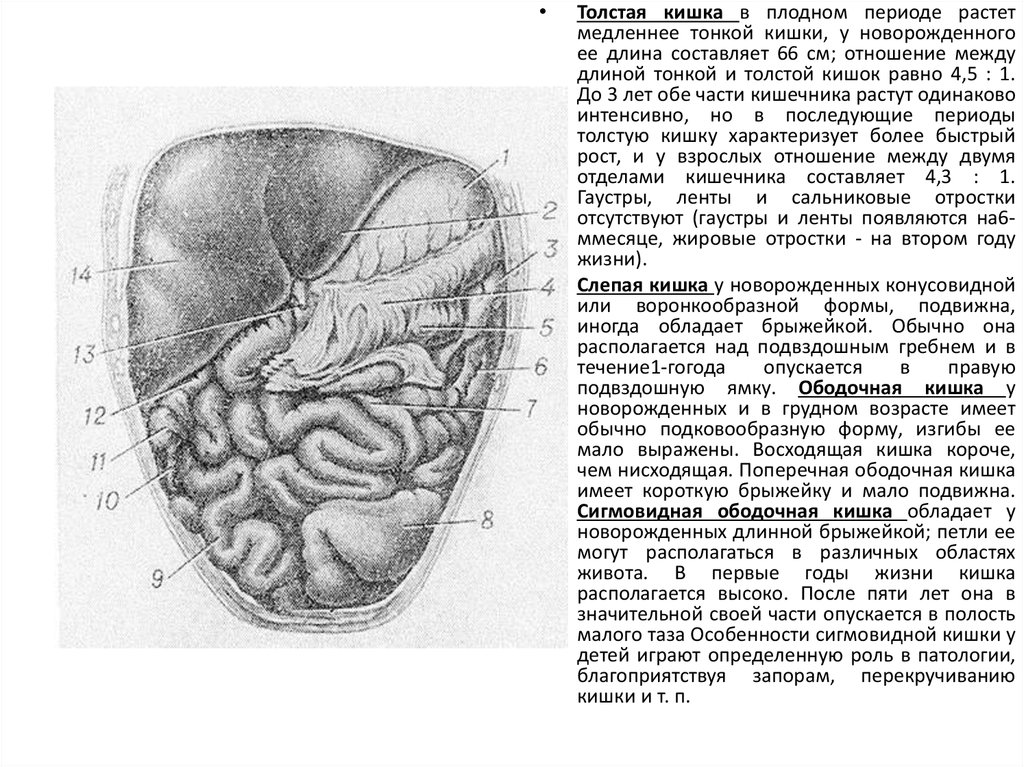 Жировой подвесок сигмовидной кишки. Перекрут жирового подвеска толстой кишки. Перекрут жирового подвеска слепой кишки. Перекрут жировой подвески сигмовидной кишки. Возрастные изменения тонкой кишки.