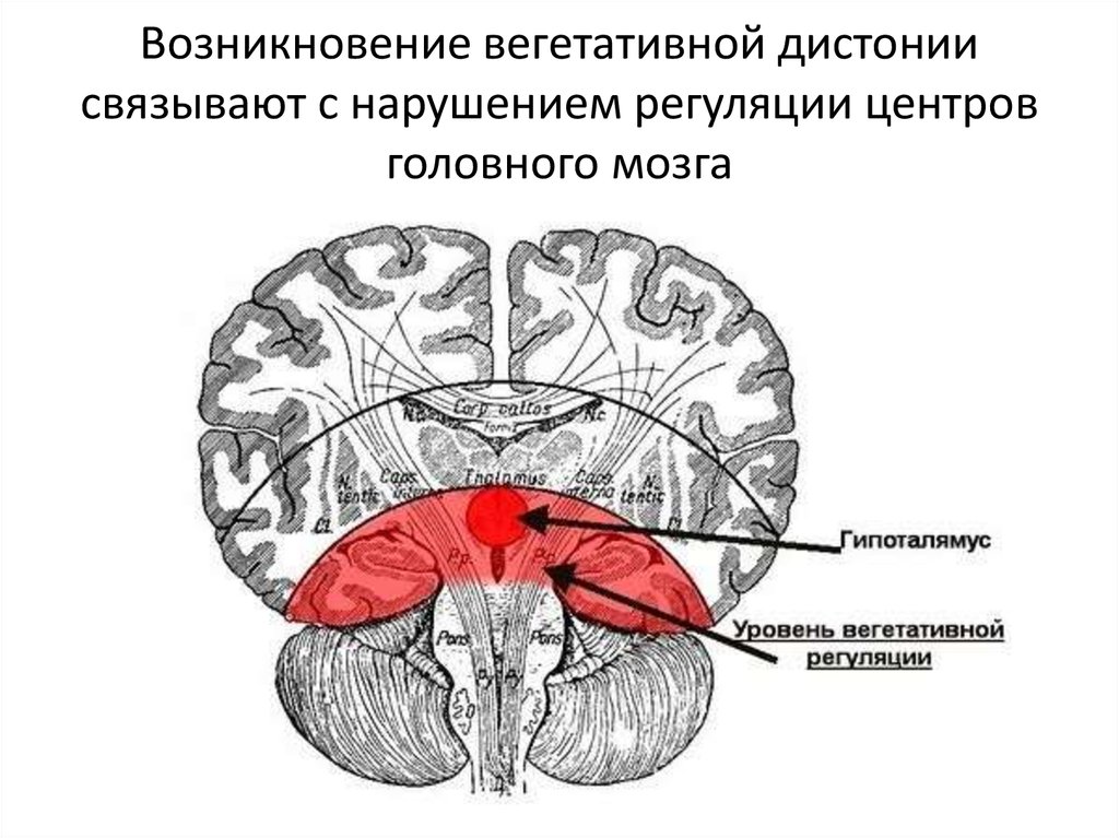 Вегетативная дисфункция головного мозга. Вегето сосудистые центры в головном мозге. Сосудисто вегетативная дистония головного мозга. Дистония это часть мозга.