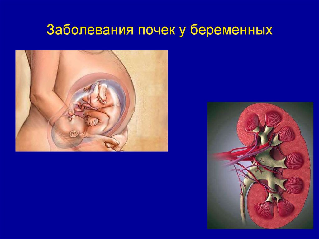 Тактика ведения беременных с экстрагенитальной патологией участковым