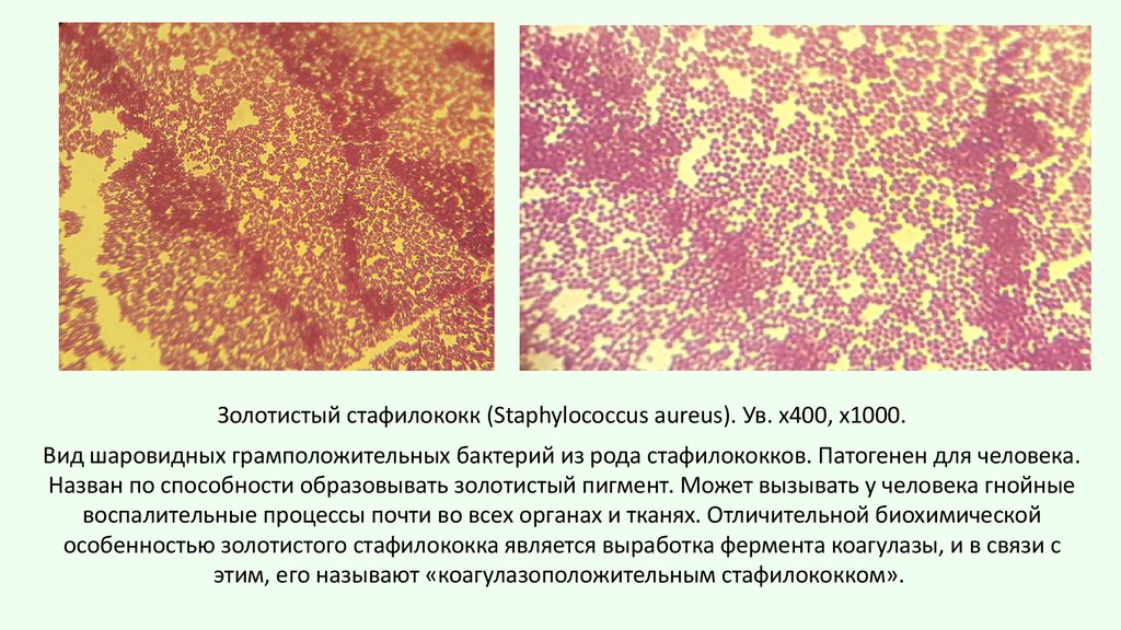 Золотистый стафилококк заболевания вызывает. Золотистый стафилококк микроскопия. Стафилококк ауреус золотистый. Стафилококк ауреус микроскопия. Золотистый стафилококк пиодермия.