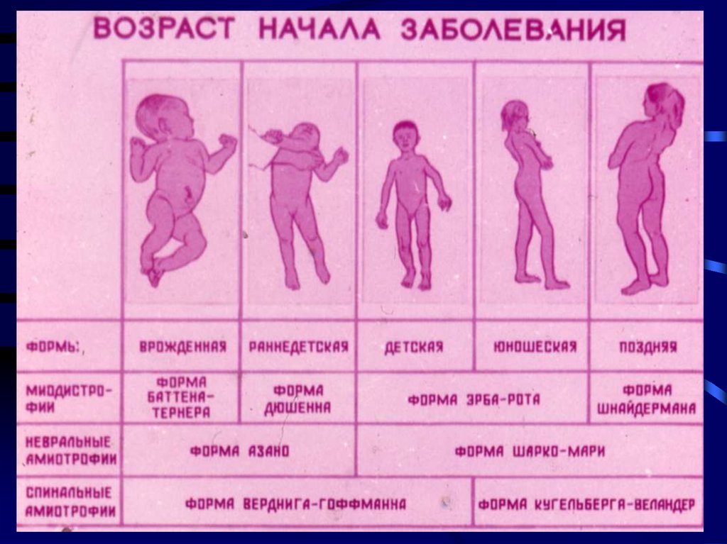 Нарушения детей в системе. Заболевания нервной системы у детей. Генетические заболевания нервной системы у детей. Заболевания нервной системы у детей до года. Патология нервной системы плода.