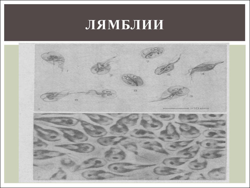 Методы протозоозов. Лямблия классификация. Лямблия систематика на латыни. Систематика лямблии на латыни.