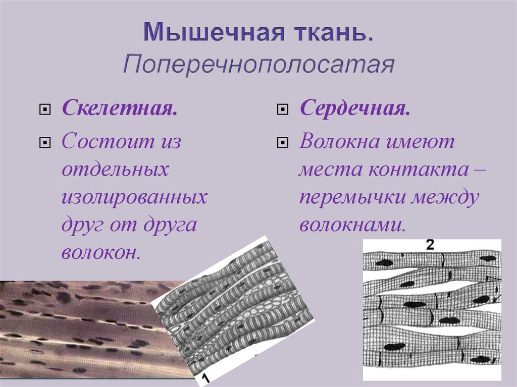 Клетка сердечной поперечно полосатой ткани