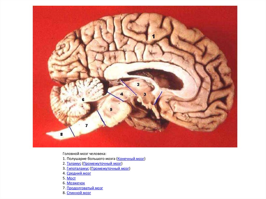 Brain 8 1. Полушарие большого мозга конечный мозг гипоталамус. Человеческий мозг в разрезе. Препарат головного мозга анатомия.