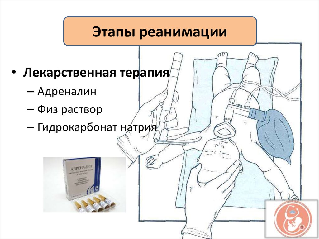 Презентация реанимация хирургия