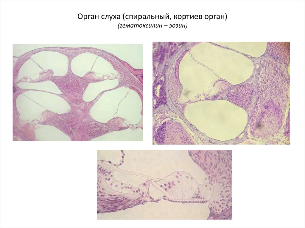 Орган слуха гистология презентация