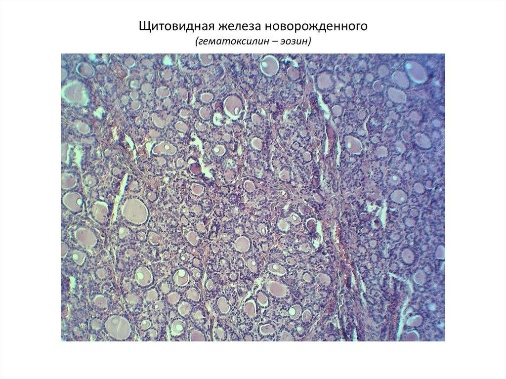 Щитовидная ткань. Щитовидная железа новорожденного гистология. Щитовидная железа гематоксилин эозин. Щитовидная железа гематоксилин эозин рисунок. Щитовидная железа гематоксилин эозин препарат.