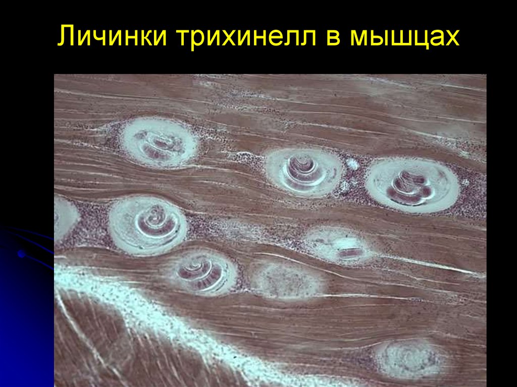 Личинки трихинеллы. Личинка трихинеллы в мышцах под микроскопом. Личинка трихинеллы в мышцах препарат.