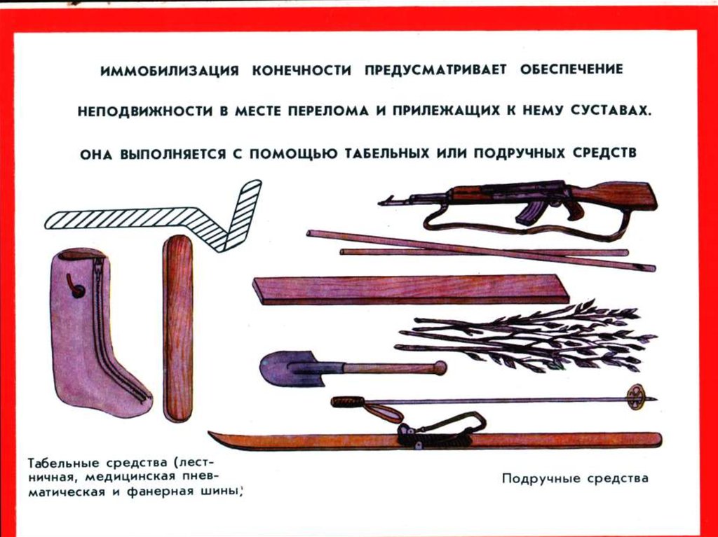 Подручные средства при переломе конечностей