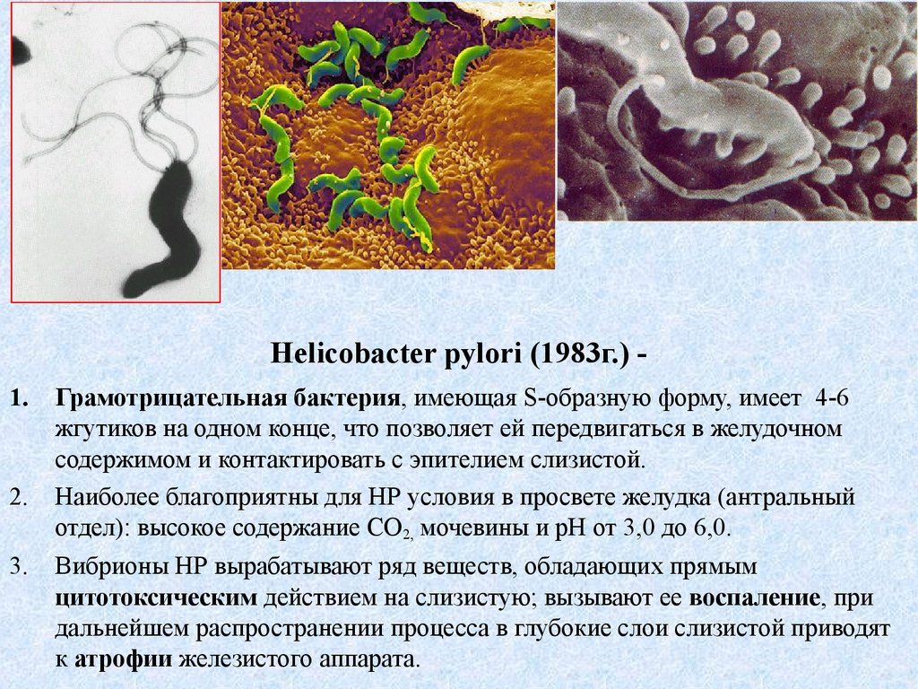 Бактерии хеликобактер причины. Язвенная болезнь хеликобактер. Helicobacter pylori колонизируется в. Язва желудка хеликобактер. Хеликобактер пилори возбудитель.