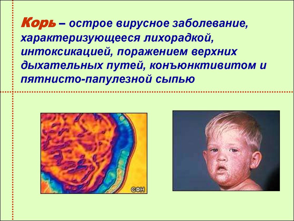 Парагрипп презентация инфекционные болезни