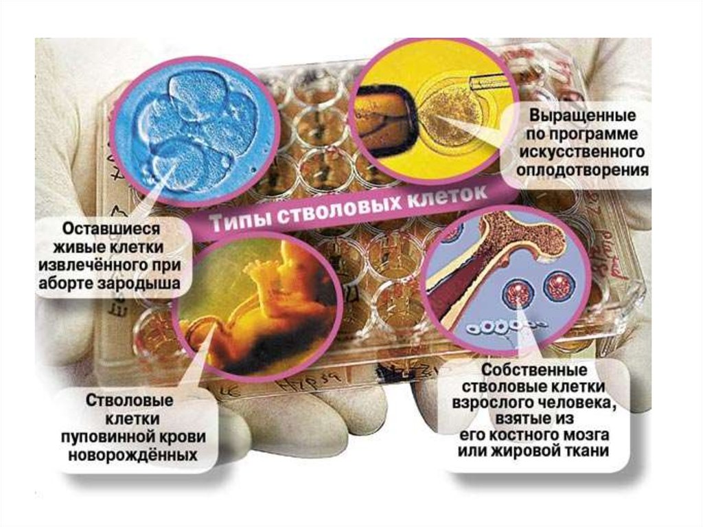 Клеточные источники. Стволовые клетки в медицине. Применение стволовых клеток в медицине. Стволовые клетки использование в медицине. Источник стаоловых клтоеу.