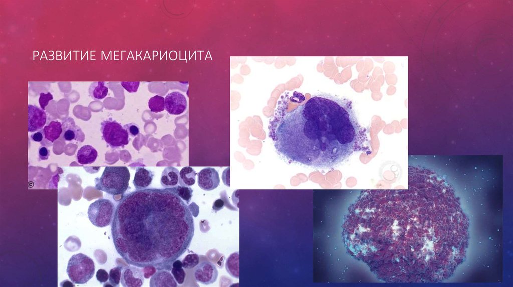 По изображению с микроскопа в строме кроветворного органа человека обнаружены мегакариоциты