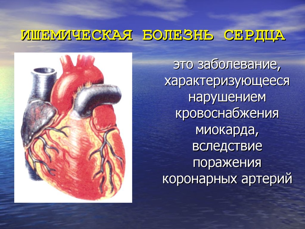 Ишемическая болезнь это заболевание. Ишемическое поражение сердца. Сообщение о заболевании сердца.