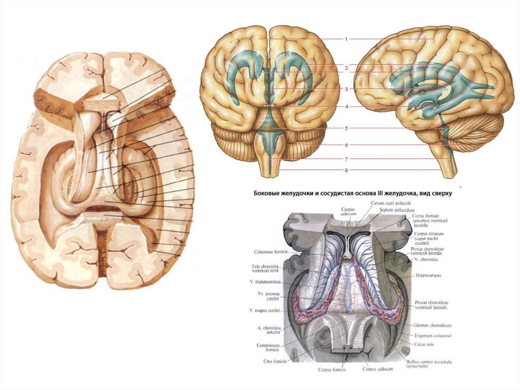 Правый желудочек головного. Сосудистое сплетение бокового желудочка. Схема желудочков головного мозга. 3 Желудочек головного мозга отдел. Строение желудочков мозга.