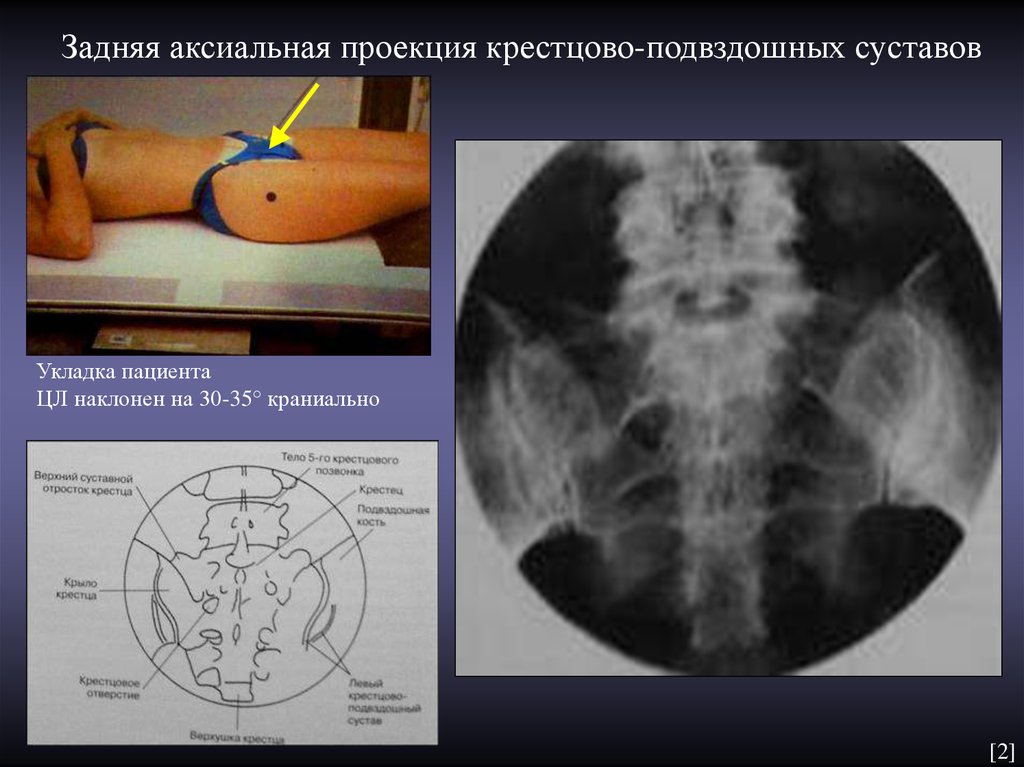 Аксиальная проекция. Анатомия в аксиальной проекции. Рентгенография в аксиальной проекции.