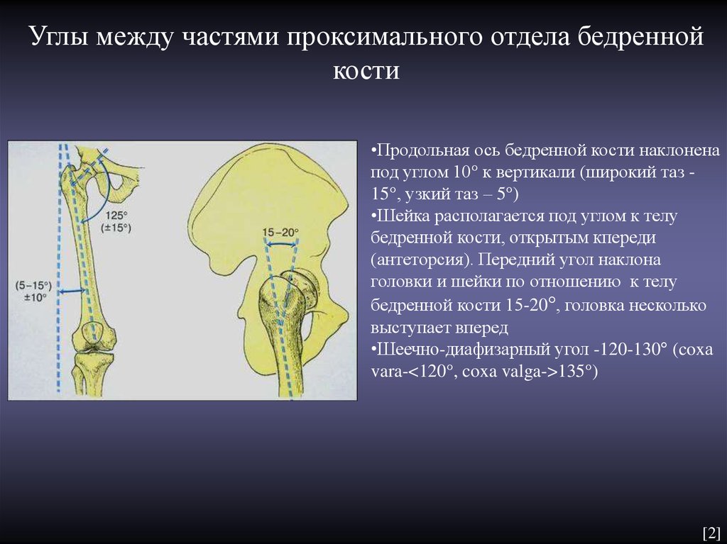 Бедренный угол. Антеторсия бедренной кости. Угол бедренной кости. Проксимальный отдел бедренной кости. Угол шейки бедренной кости.