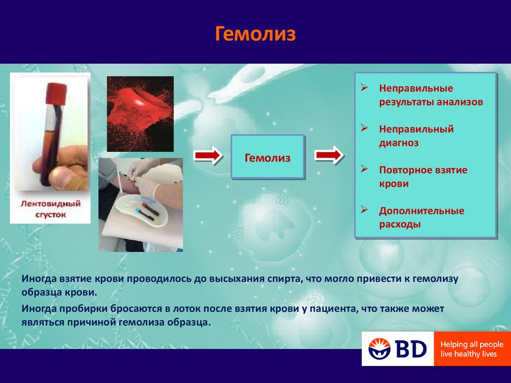 Почему при сдаче крови кровь свернулась. Гемолиз в пробирке причины. Гемолиз в анализе крови. Анализ крови на гемолизис. Факторы приводящие к гемолизу эритроцитов.