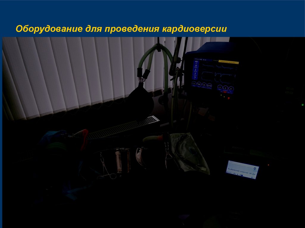 Оборудование для проведения кардиоверсии
