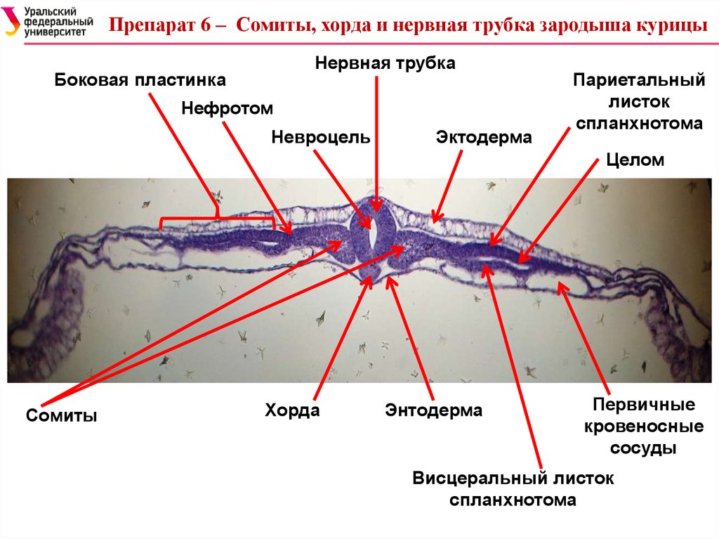 Развитие хорды человека. Сомиты хорда и нервная трубка зародыша курицы. Препарат сомиты хорда нервная трубка. Сомиты хорда и нервная трубка зародыша курицы препарат. Нервная трубка хорда сомиты курицы.