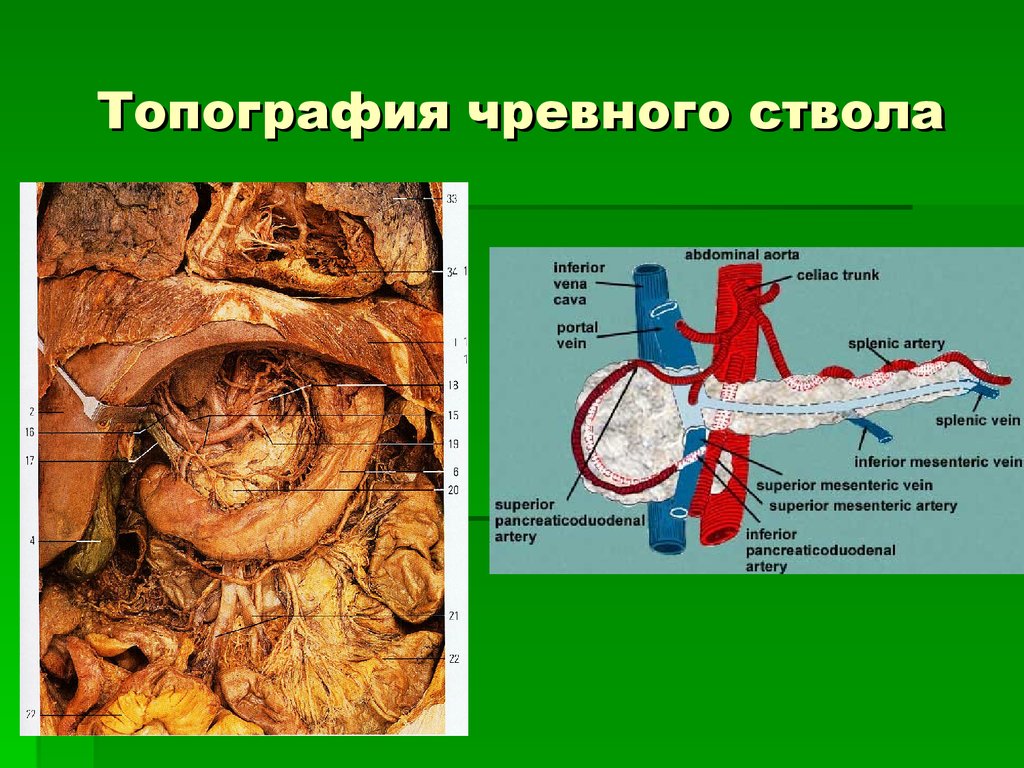 Чревный ствол и его ветви. Чревный ствол анатомия препарат. Чревный ствол брюшной аорты анатомия. Чревный ствол анатомия топография. Кровоснабжение чревного ствола.