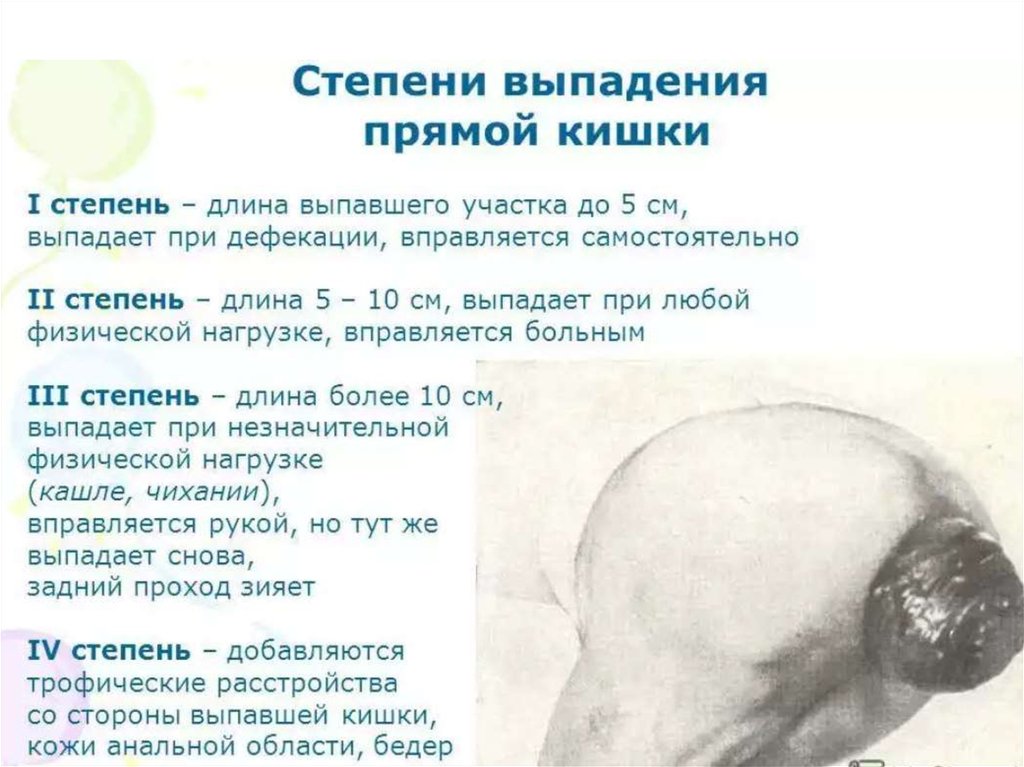 Выпадение прямой кишки - презентация онлайн