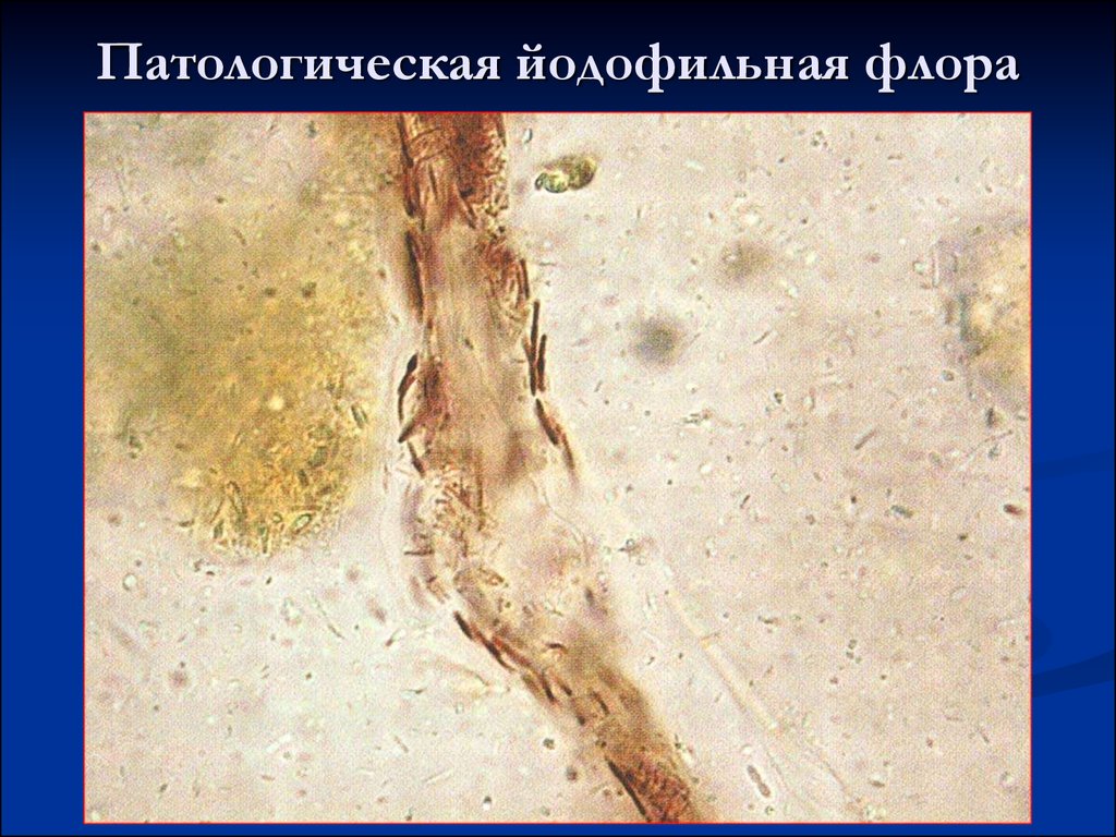 Бактерии в копрограмме. Йодофильная микрофлора (клостридии).
