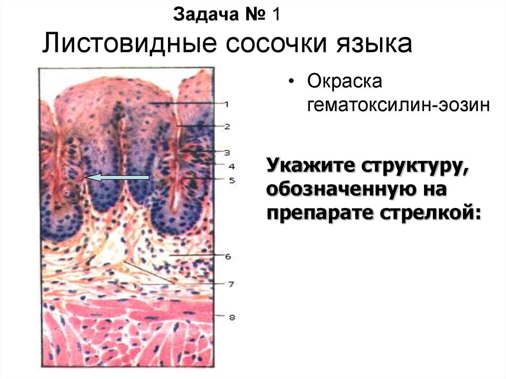 Листовидные сосочки гистология препарат