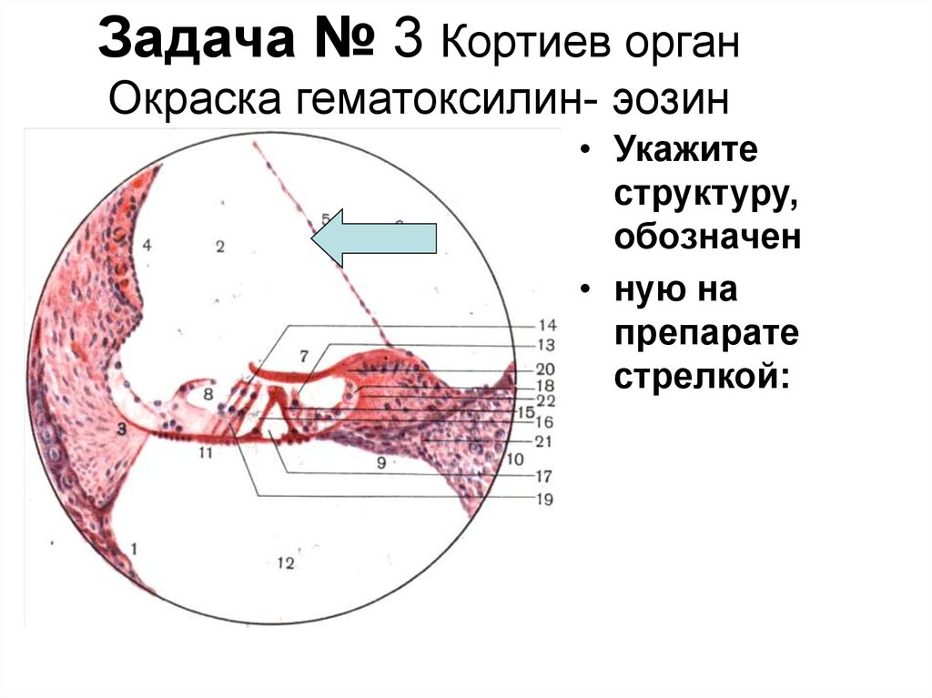 Кортиев орган. Кортиев орган гистология препарат. Кортиев орган окраска гематоксилин-эозином. Кортиев орган строение препарат. Кортиев орган гистология препарат с подписями.