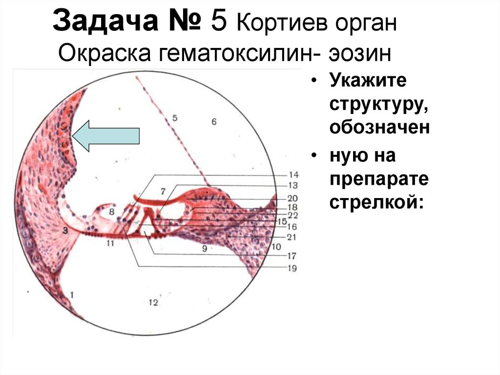 Аксиальный срез улитки схема строения спирального органа кортиев орган