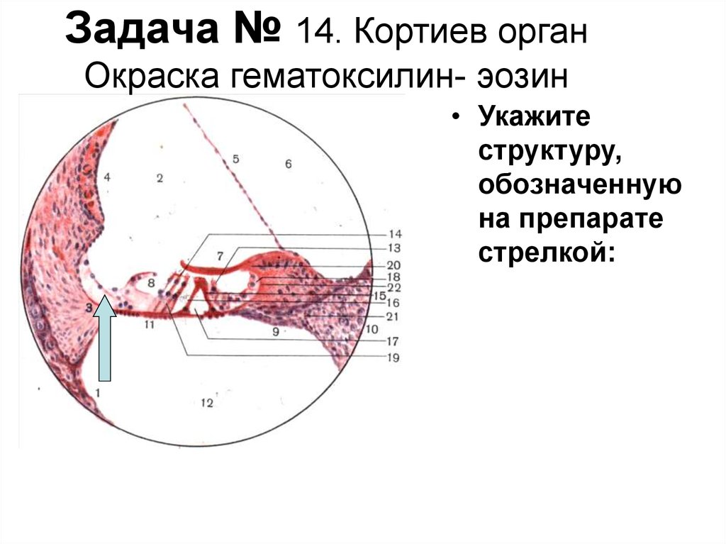 Орган слуха гистология презентация