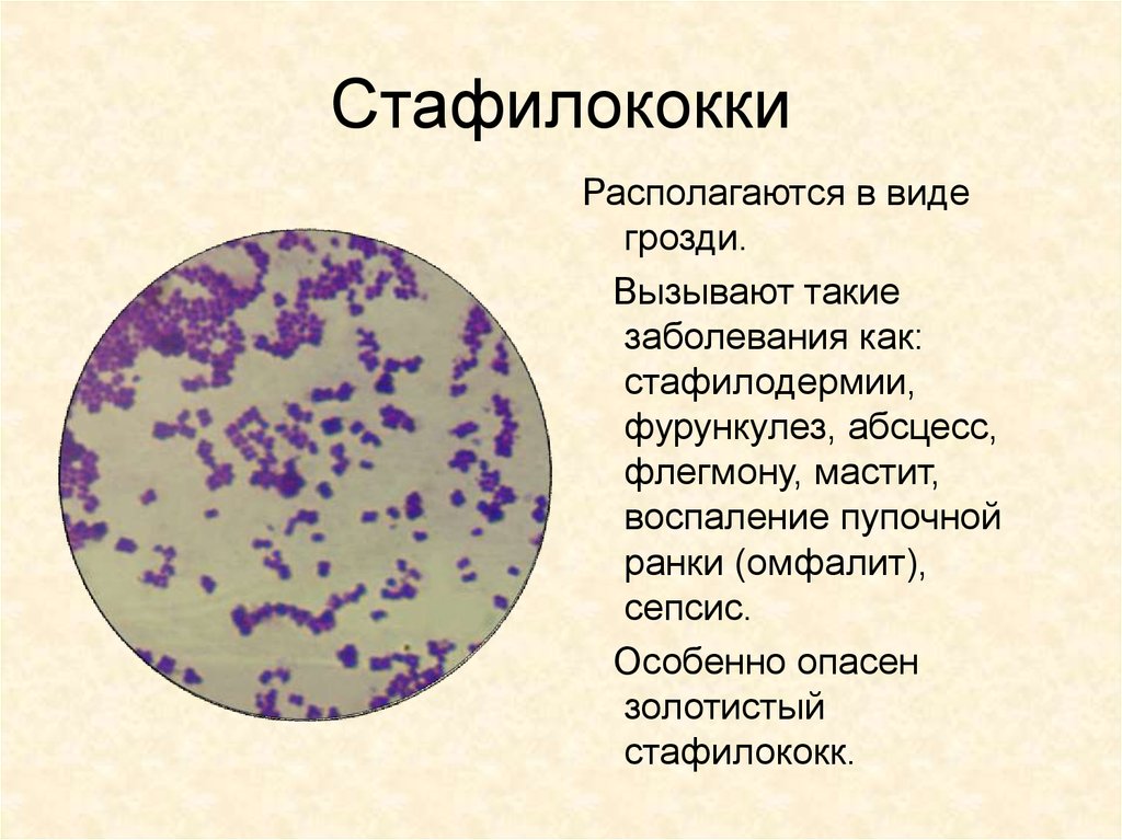 Бактерии staphylococcus aureus. Стрептококк строение клетки. Бактерия стафилококк строение. Стафилококки возбудитель заболевания. Стафилококк строение.
