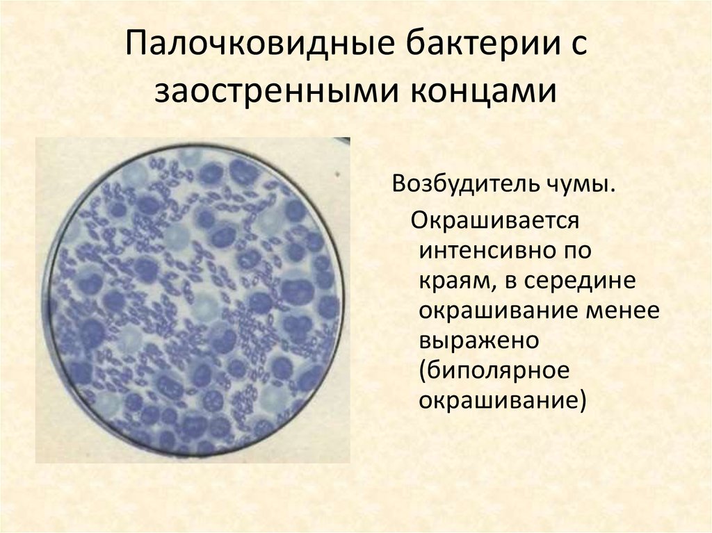 Подпиши формы бактерий. Строение бактериальной клетки. Особенности строения бактериальной клетки. Прокариотическая клетка строение кратко. Особенности строения бактериальной клетки 9 класс.