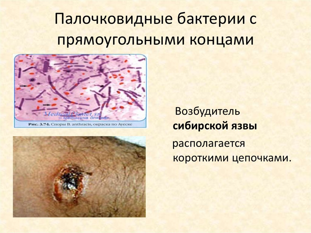 Палочковидные бактерии с прямоугольными концами