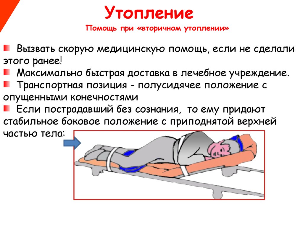 Что общего между беременной женщиной утопленником и сгоревшим пирогом