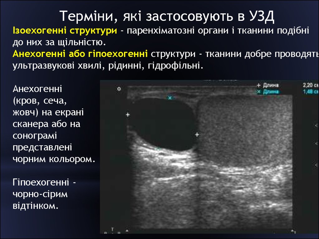 Аваскулярное округлое образование