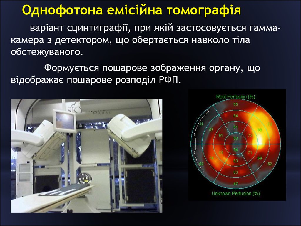 Получить послойное изображение органа позволяет