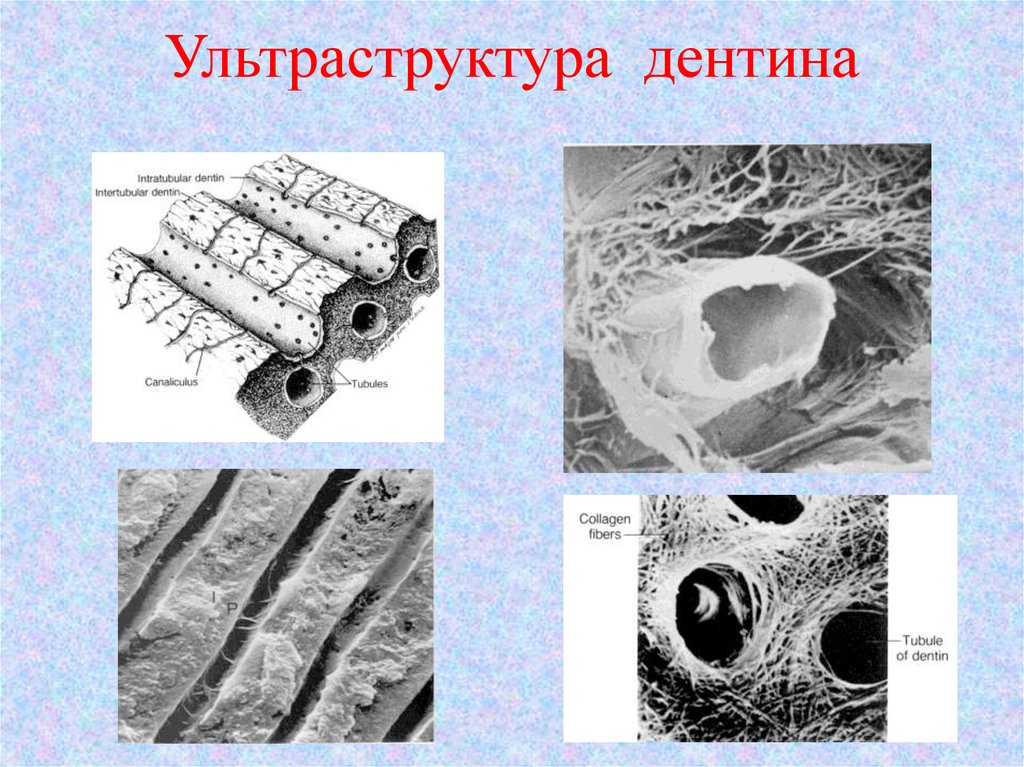 Дентин. Строение дентина гистология. Строение дентина микроскоп. Микроскопическое строение дентина гистология. Гистологическое строение дентина зуба.