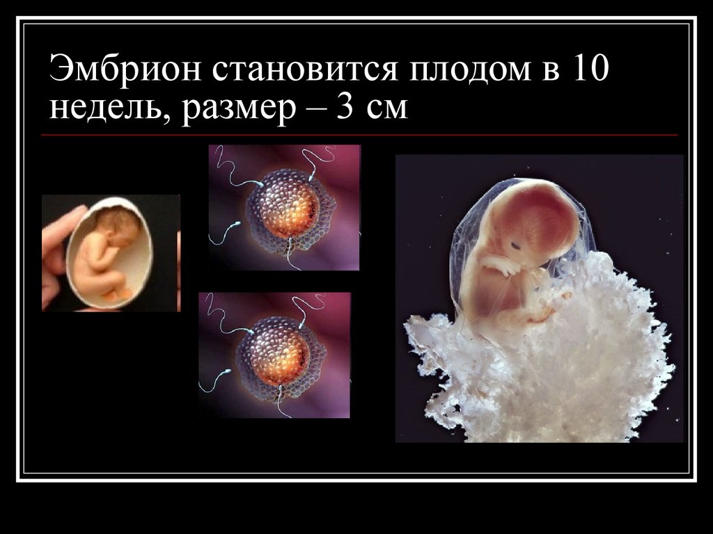 Симптомы 10 недели. 10 Недель беременности размер плода. Эмбрион на 10 неделе беременности. Размер эмбриона в 10 недель.