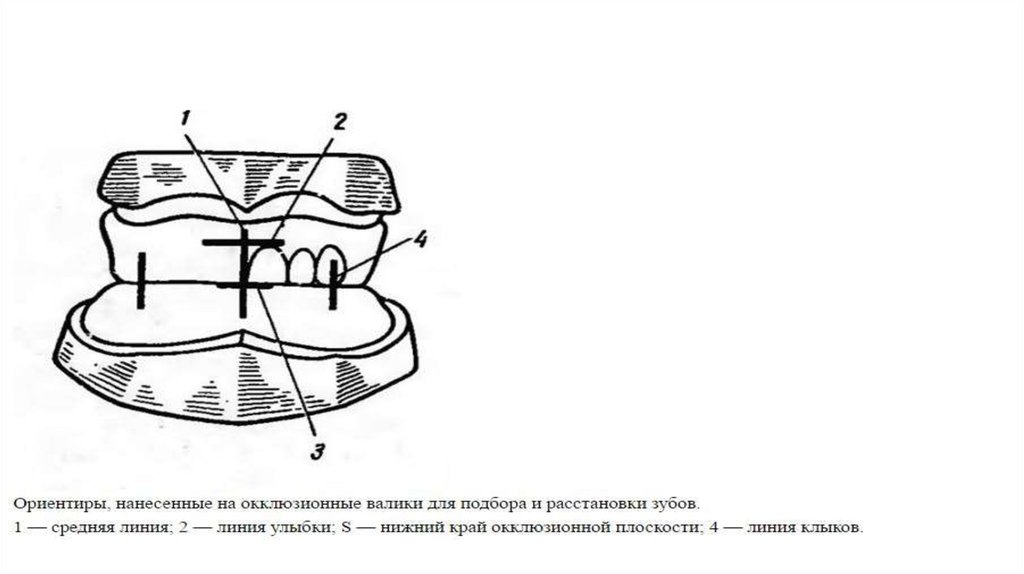 Определение центрального соотношения челюстей презентация