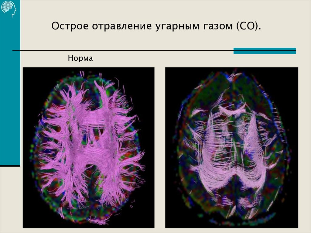 Институт мозга человека имени н п бехтеревой