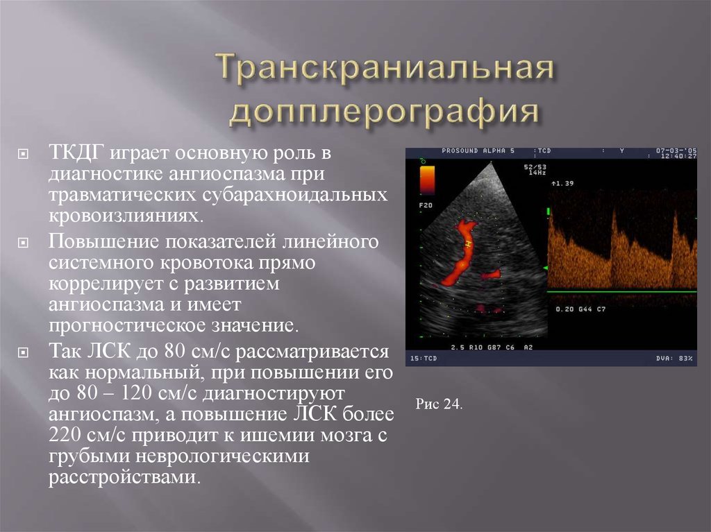 Ангиоспазм это. Транскраниальная допплерография сосудов головного мозга заключение. Транскраниальный ультразвуковой допплер. Датчик транскраниальная допплерография сосудов головного мозга. Транскраниальная допплерография сосудов головного мозга норма.