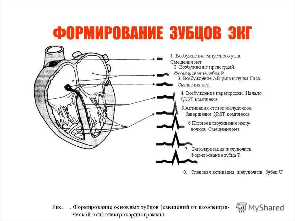 Что означает экг. ЭКГ расшифровка зубцов. Формирование зубцов ЭКГ. Проводящая система сердца и формирование зубцов ЭКГ. Как формируются зубцы на ЭКГ.