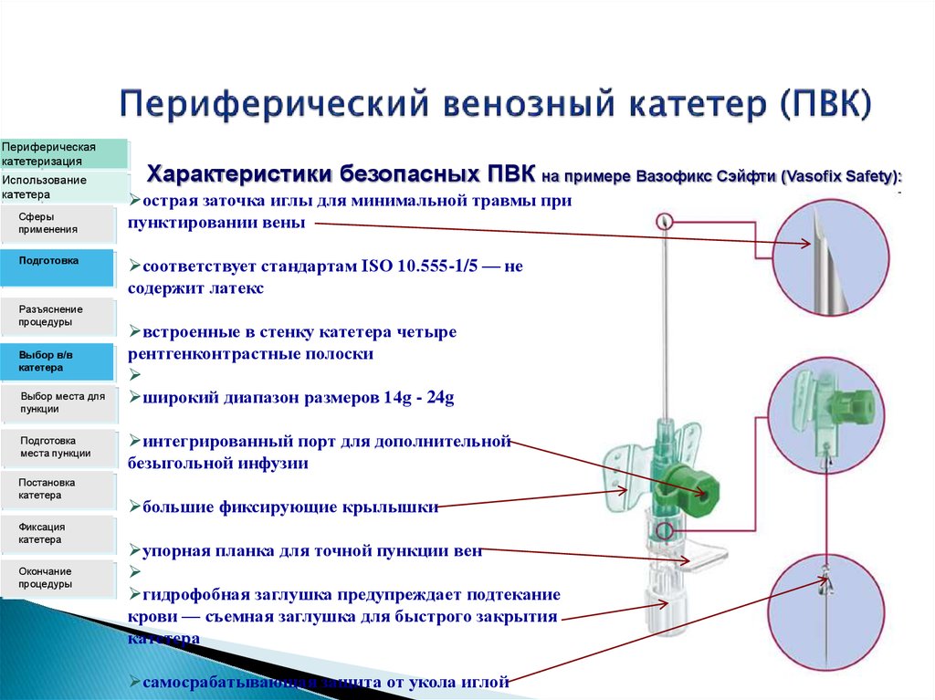 Схема постановки внутривенного катетера