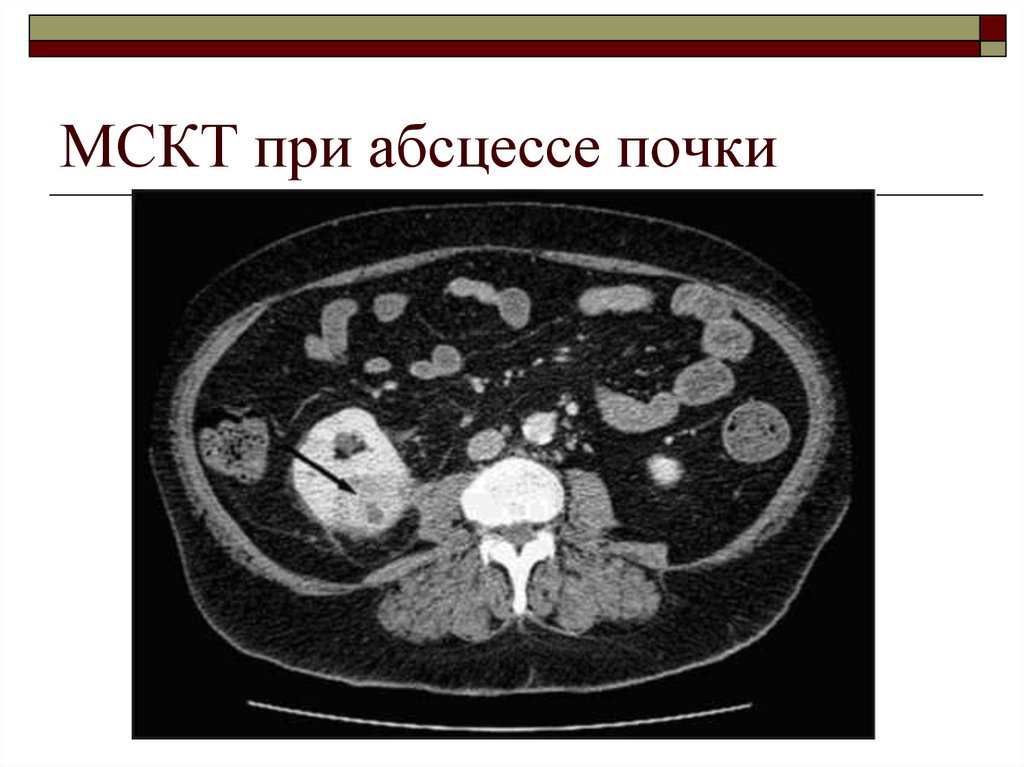 Кт картина дерево в почках